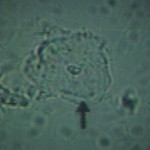 Normal vaginal epithelial cell